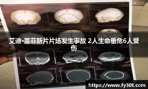 艾迪·墨菲新片片场发生事故 2人生命垂危6人受伤